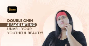 Double Chin & Face Lifting