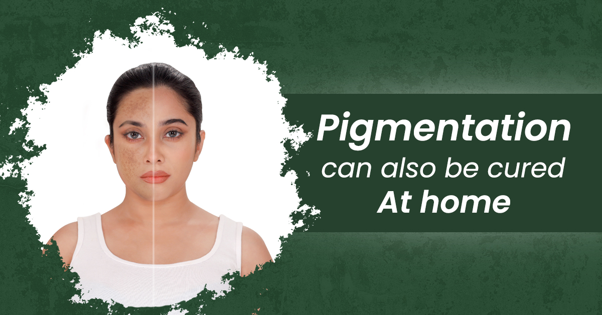 Pigmentation can also be cured at home !