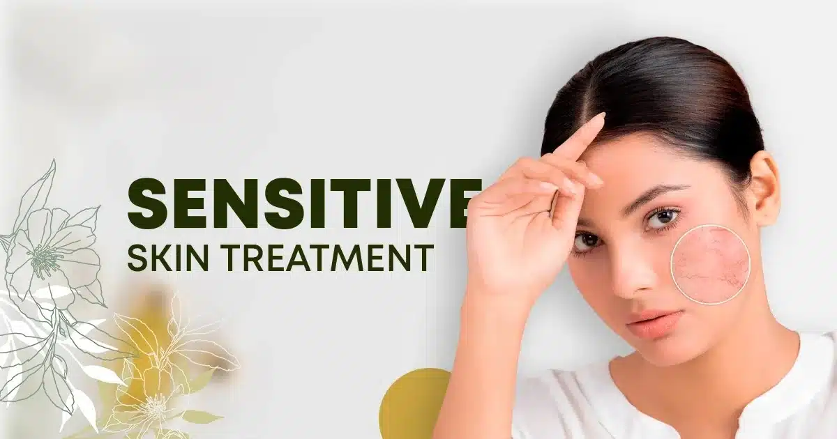 Sensitive Skin Treatment