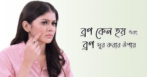 ব্রণ কেন হয় এবং ব্রণ দূর করার উপায়