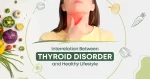 Interrelation between thyroid disorder and healthy lifestyle