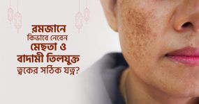 রমজানে কিভাবে নেবেন মেছতা ও বাদামী তিলযুক্ত ত্বকের সঠিক যত্ন?